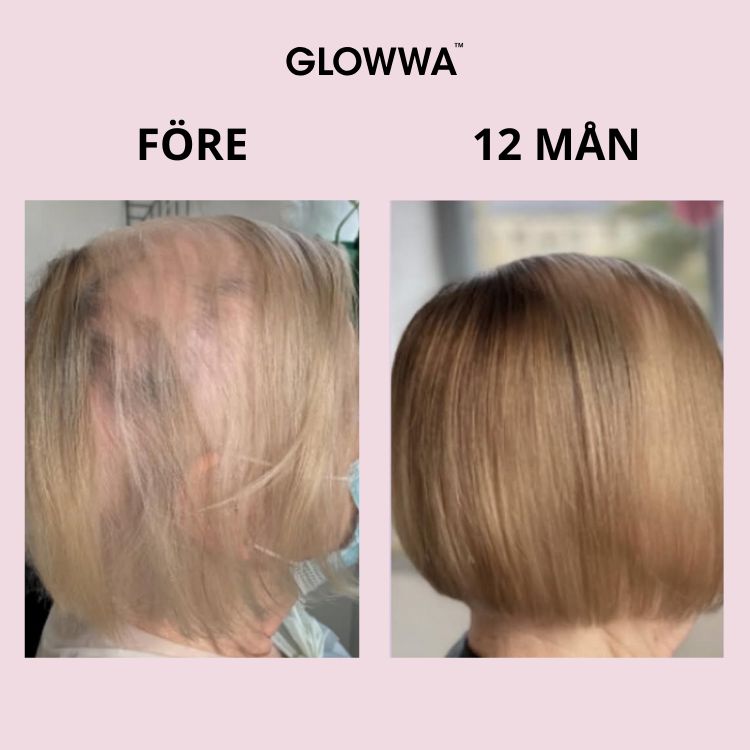 före och efter bilder på jane glowwa